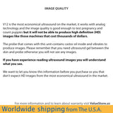 Portable Ultrasound Scanner Veterinary Pregnancy V12 with 3.5 MHz Convex Probe