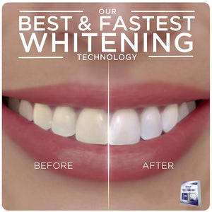 Crest 3D Whitestrips With Light Teeth Whitening Strip Kit 20 Strips 10 Treatment