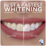 Crest 3D Whitestrips With Light Teeth Whitening Strip Kit 20 Strips 10 Treatment
